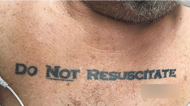 Il avait un tatouage "ne pas réanimer", les médecins le laissent mourir