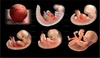 L’embryon humain : la victime silencieuse et innocente de la révision de la loi de bioéthique