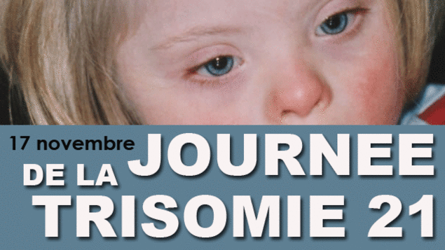 Jean-Marie Le Méné : « A quand une politique de santé publique positive pour les trisomiques ? »